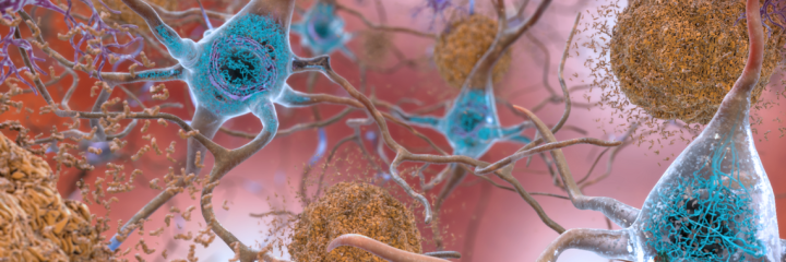Untangling the role of tau in Alzheimer’s disease