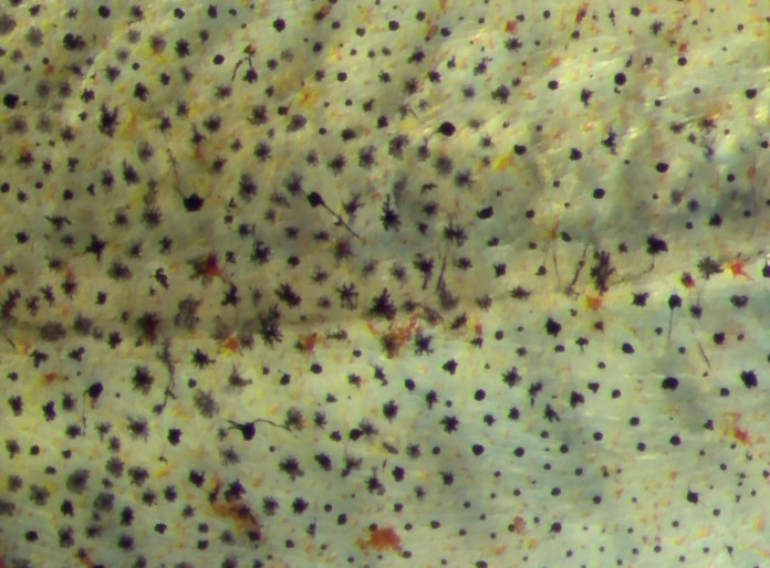 Pigment Cells in Clownfish Skin