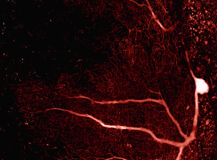 Double-tree human Purkinje neuron	