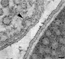 caveolae