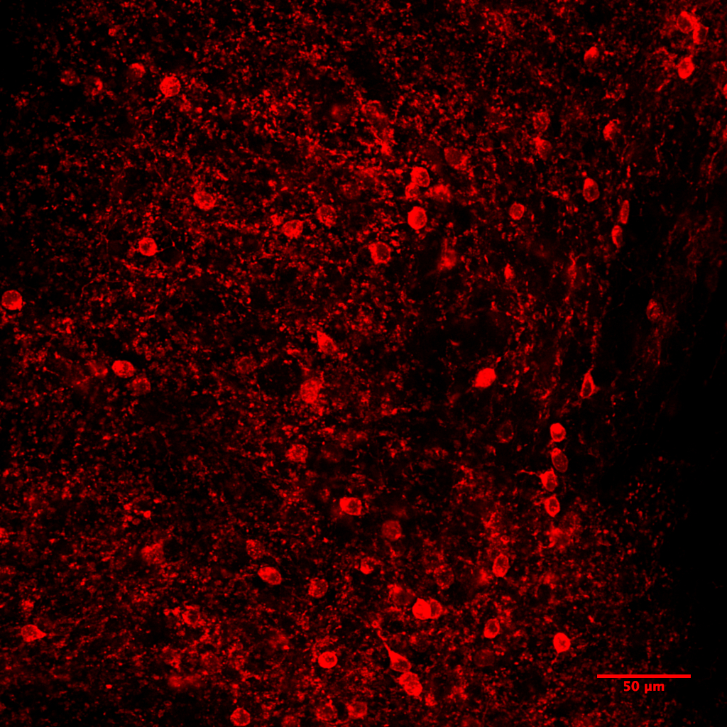 蛍光神経細胞