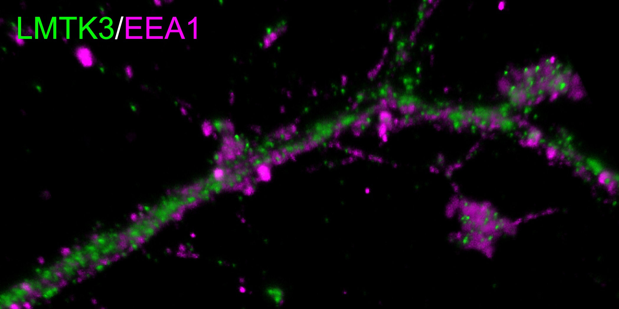 神経細胞内におけるLMTK3と初期エンドソームの局在