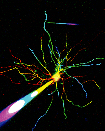 視床ニューロン