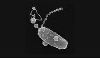 gray ovals on the black background