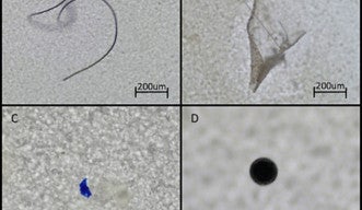 Plastitective — Fast and Efficient Microplastic Detection