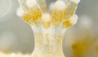 トゲサンゴSeriatopora hystrixのポリプに共生している褐虫藻(茶色)