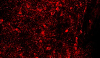 Fluorescing Neurons
