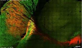 Panoramic view of a mouse brain including the neostriatum.