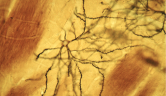 Spiny Neurons Receive Dopamine