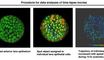 各細胞の発達過程を追跡する方法。左図は共焦点顕微鏡を使って上皮細胞を観察した画像。中央は、各細胞を分裂経験細胞（黄色）、非分裂細胞（水色）、細胞死に至る細胞（紫色）に色分けした画像。右図は各細胞の移動軌跡を線で示した画像で、移動軌跡の線上にその時点での移動速度を色で示したもの。
