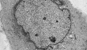ネクロプトーシスを起こしているマウス細胞
