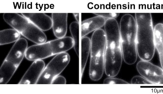コンデンシンは染色体分配のキープレーヤーである