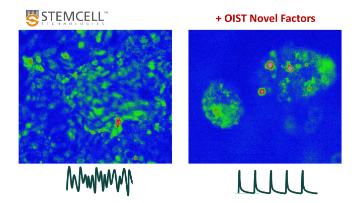 POC project (86-Taoufiq): Calcium transients in cardiomyocytes