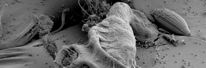 Hidden in genetics: The evolutionary relationships of two groups of ancient invertebrates revealed