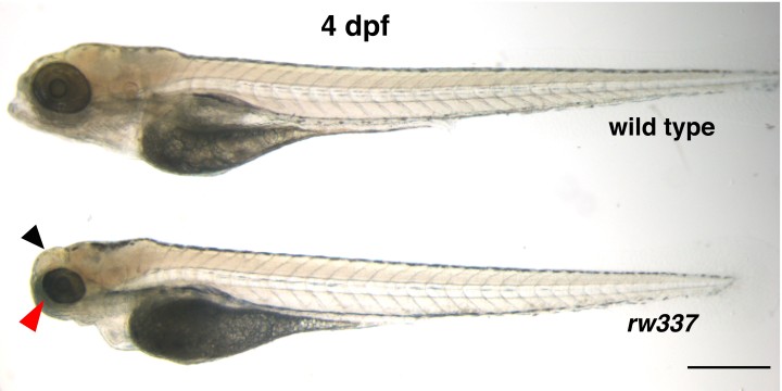 The embryo of a wild type zebrafish above the embryo of banp mutant zebrafish, both four days post fertilization (dpf). The mutant embryo has smaller eyes compared to the wild type (shown with the red arrow). The black arrow shows cloudy tectum (the uppermost part of the midbrain) in the mutant embryo, which represents cell death. Scale bar = 100 μm. The image appeared in the research paper published in eLife.