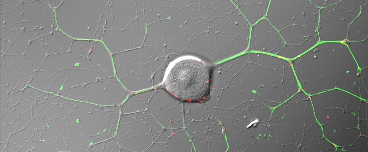 DRG neurons mnu banner