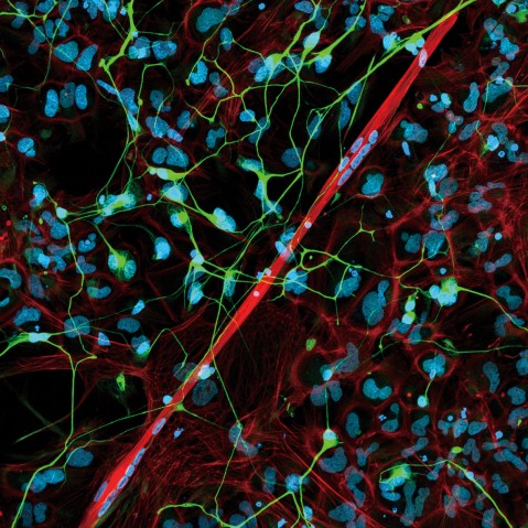 Human Neuro-muscular Junction in a Dish