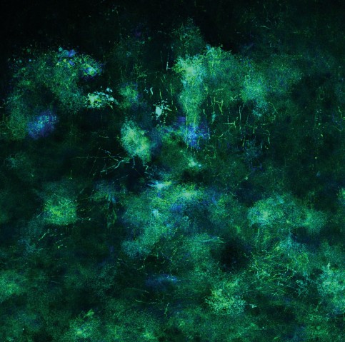 Astrocytes in Sensorimotor Cortex 