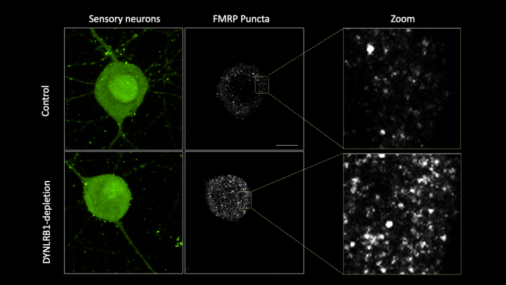 A comparison of control sensory neurons and sensory neurons in which Dynlrb1 has been depleted. 