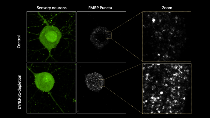 コントロール群の感覚ニューロンと、DYNLRB1が欠損した感覚ニューロンを比較した画像。緑色の部分がニューロンで、FMRP顆粒（FMRP puncta）は白点として可視化した。