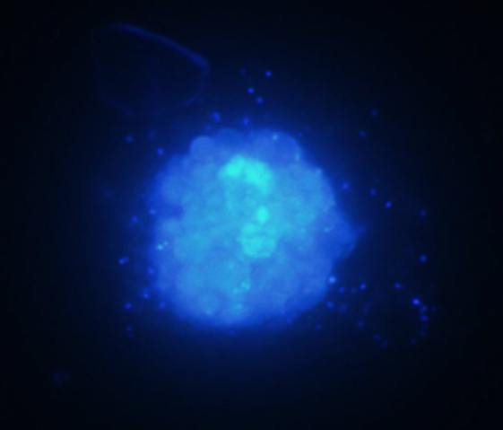 mbsmu FY2011 Annual Report 01