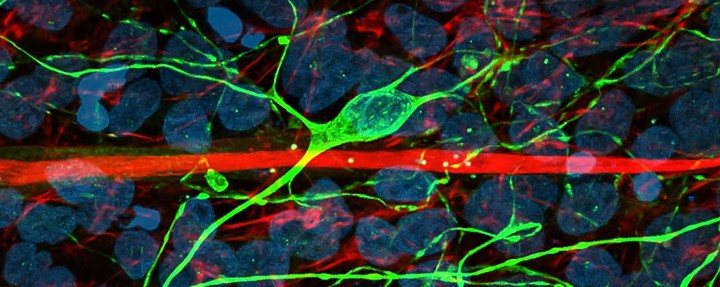 Axonal Degeneration and Regeneration