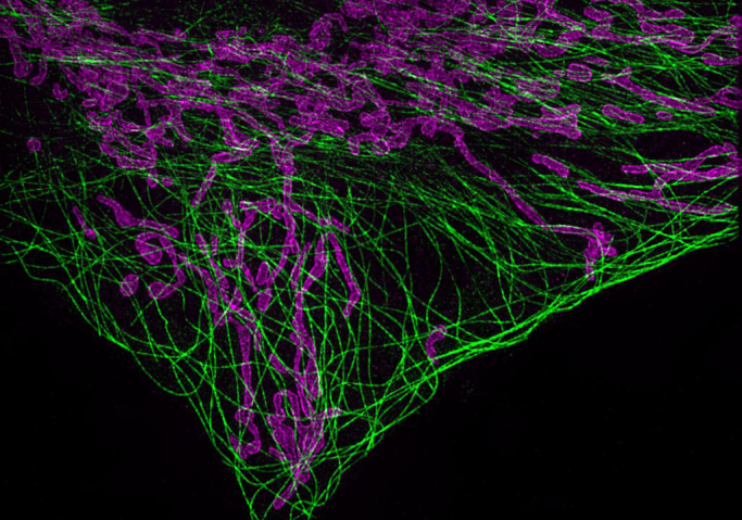 Super-resolution image of mitochondria in purple and filaments of tublin in green