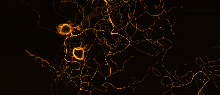Confocal microscope image of neurons in fluorescence