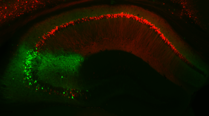 Hippocampus fluorescent