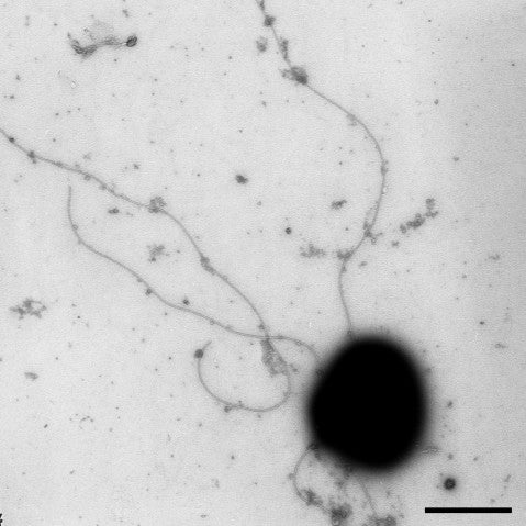 Negative-stain EM micrograph of H. marismortui cell. Scale bar - 1 micrometer.