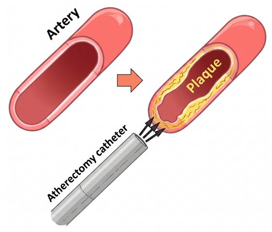 TPF 50- Victoras: Figure 1