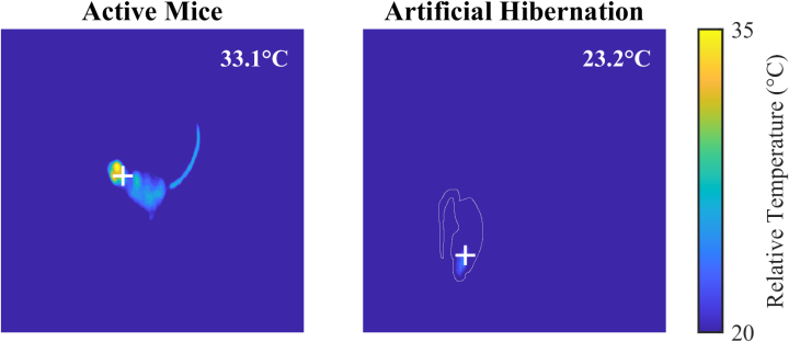 Artificial hibernation