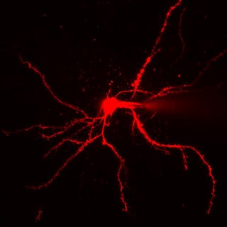 large_neuron