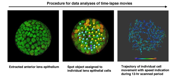 Tracking procedure of individual cell growth. Left: Individual lens epithelial cells are observed using a confocal microscope. Middle: Each cell is assigned a spot of a specific color, depending on the cell’s classification: dividing, non-dividing, or dead/dying. Right: The movement patterns of each cell are tracked and marked by a trajectory line. The color of the line indicates the speed at a particular location.