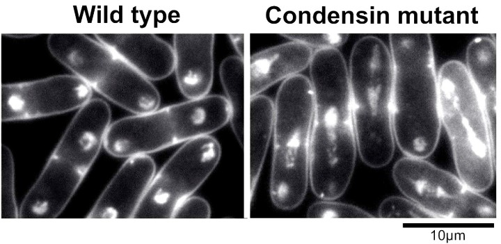 コンデンシンは染色体分配のキープレーヤーである