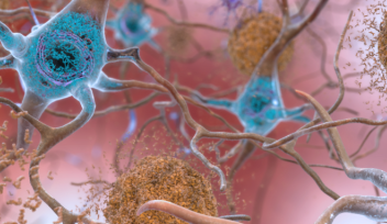 Untangling the role of tau in Alzheimer’s disease