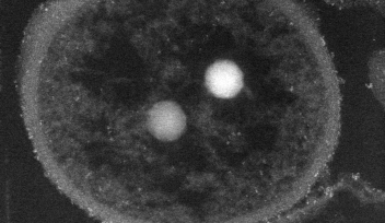 A bacterial cell with cadmium-containing granules (light spots)