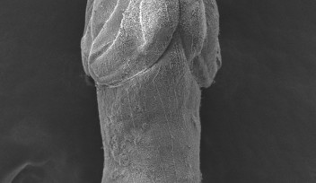 新種の条虫類Nybelinia enterika の走査電子顕微鏡（SEM:Scanning Electron Microscope）写真。ずんぐりとした体と4本の鉤状の触手が見える。 研究チームはこの新種の和名を「イカチュウチュウ」と提案している。