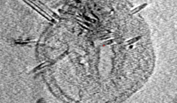 Viruses Attack Microbe