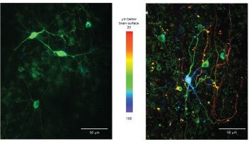 Lugaro cells and a Golgi cell