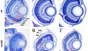Zebrafish Retina Development