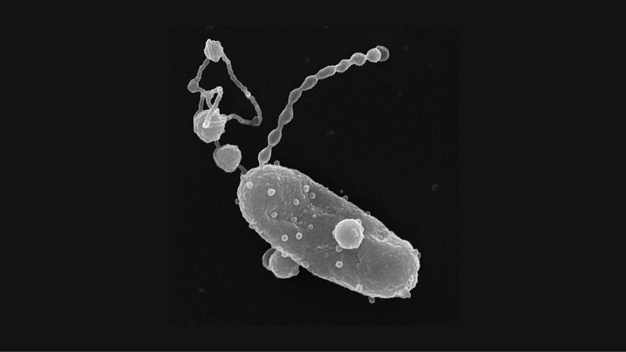 gray ovals on the black background