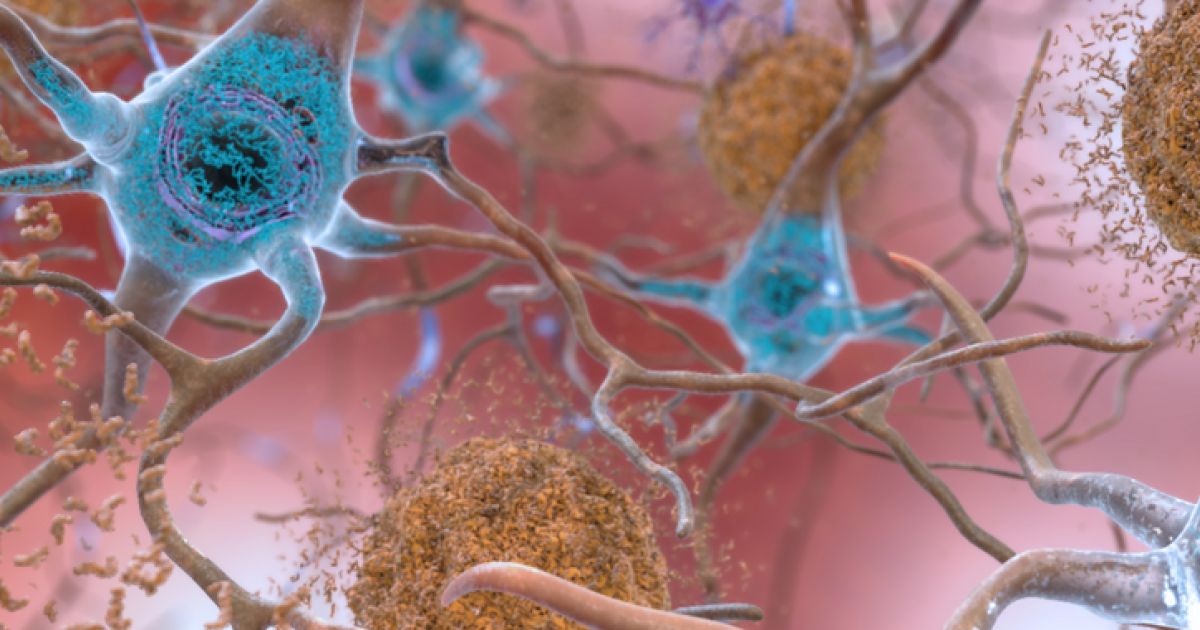 Untangling the role of tau in Alzheimer’s disease | Okinawa Institute ...