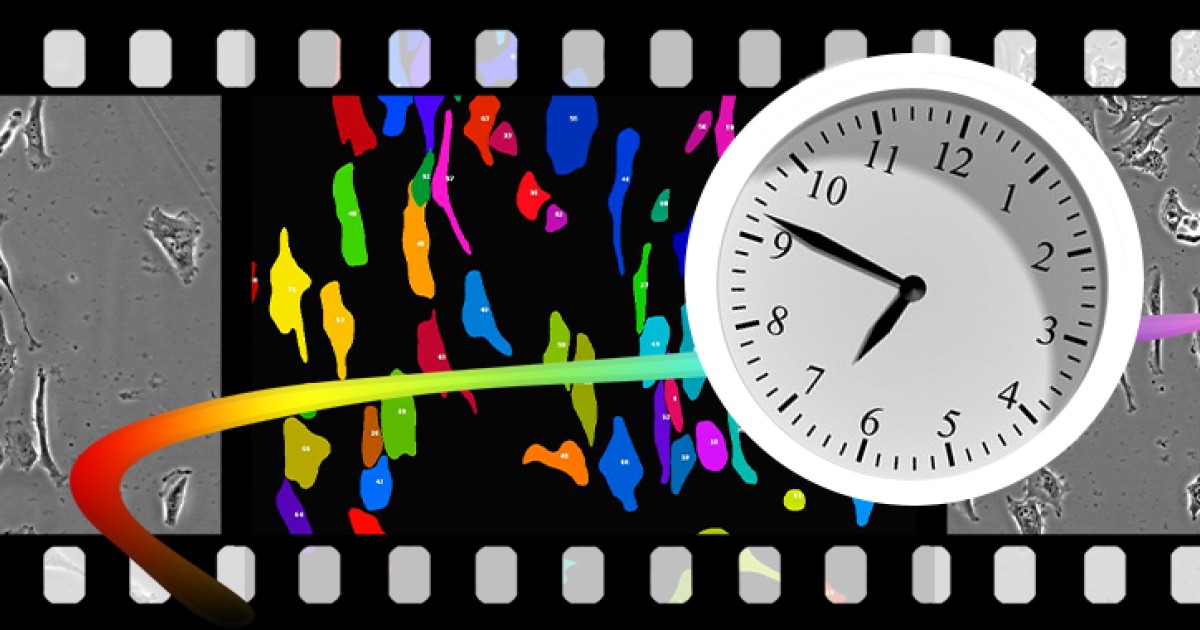 人工知能が遊走する細胞を追跡する 沖縄科学技術大学院大学 Oist