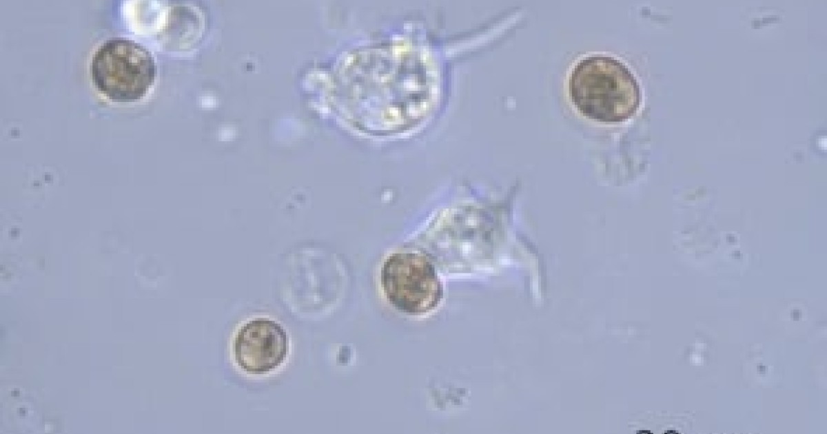 サンゴ細胞が褐虫藻を飲み込む | 沖縄科学技術大学院大学（OIST）