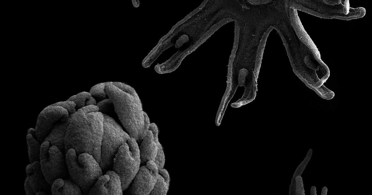 Stages of jellyfish metamorphosis Okinawa Institute of Science and